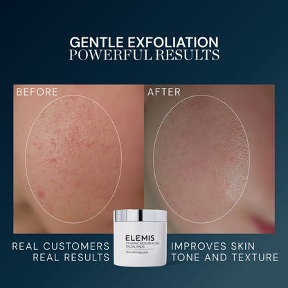 Dynamic Resurfacing Facial Pads